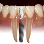 Sedation dentist fresno
